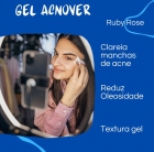 Ruby Rose Acnover - Gel Antiacne 30g