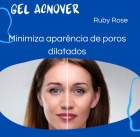 Ruby Rose Acnover - Gel Antiacne 30g