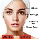 Ruby Rose Acnover Pomada Secativa - Creme Facial 15g